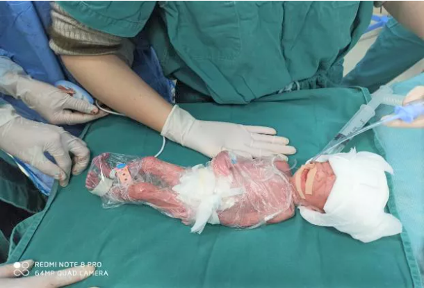 怀孕30周早产宝宝图片图片